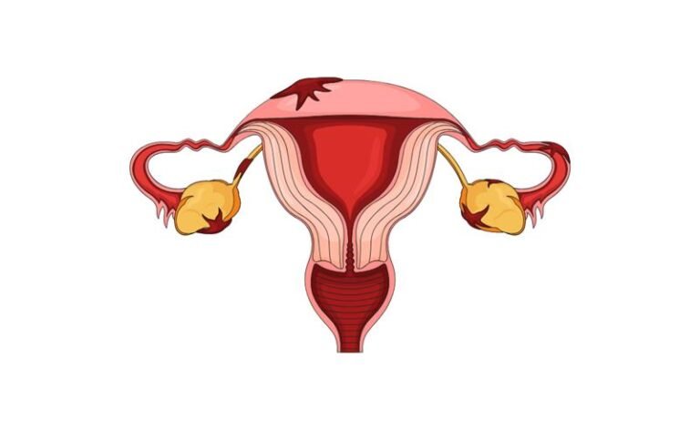 Março Amarelo: Larissa Manoela compartilha diagnóstico de endometriose e reforça importância da informação para mulheres